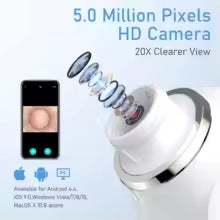 LumaPore Pro™ – Aspiratore Punti Neri con Micro-Camera HD